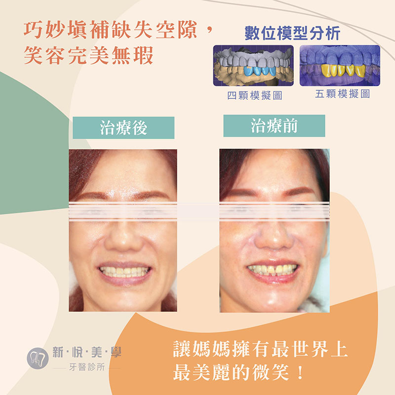 愛笑的媽媽最美麗，生活更美好的第2張圖片